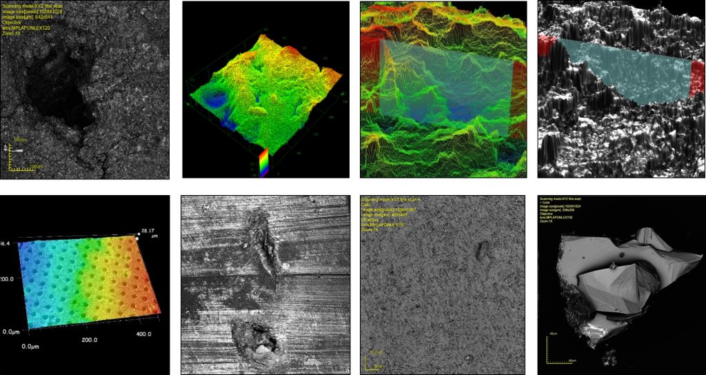 Combined Confocal Laser Scanning Microscopy Images in Special techologies at Anapath